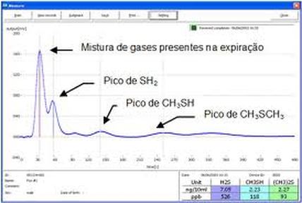 Novas metodologias e exames, facilitam o diagnóstico das causas e o tratamento dos problemas de mau hálito